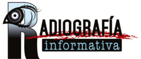 Radiografía Informativa